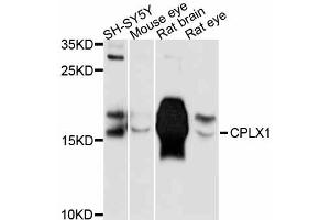 Western blot analysis of extracts of various cell lines, using CPLX1 antibody (ABIN5997502) at 1:3000 dilution. (Complexin 1 anticorps)
