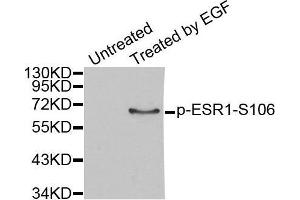 Western blot analysis of extracts from MCF7 cells, using Phospho-ESR1-S106 antibody. (Estrogen Receptor alpha anticorps  (pSer106))