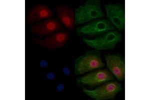 ABIN6258930 and ABIN6275667 staining Hela cells by IF/ICC. (UGDH anticorps  (C-Term))