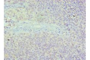 Immunohistochemistry of paraffin-embedded human tonsil tissue using ABIN7143615 at dilution of 1:100 (Adracalin anticorps  (AA 287-546))