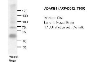 Image no. 2 for anti-Adenosine Deaminase, RNA-Specific, B1 (ADARB1) (N-Term) antibody (ABIN183933) (RED1 anticorps  (N-Term))
