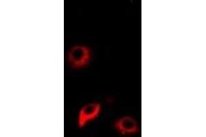 Immunofluorescent analysis of NNMT staining in Hela cells.