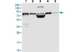 Western blot analysis of Lane 1: RT-4, Lane 2: U-251 MG, Lane 3: Human Plasma, Lane 4: Liver, Lane 5: Tonsil with PEX5 polyclonal antibody  at 1:250-1:500 dilution. (PEX5 anticorps)