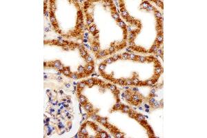 Immunohistochemical analysis of paraffin-embedded M. (MPP7 anticorps  (N-Term))