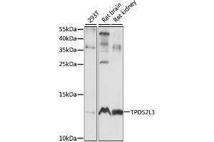 Western blot analysis of extracts of various cell lines, using TPD52L3 antibody.