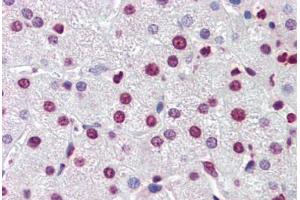 Human Liver (formalin-fixed, paraffin-embedded) stained with NR1H3 antibody ABIN462212 followed by biotinylated goat anti-rabbit IgG secondary antibody ABIN481713, alkaline phosphatase-streptavidin and chromogen.