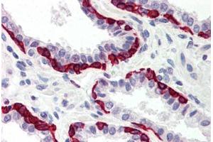 Human Prostate (formalin-fixed, paraffin-embedded) stained with DAPK2 antibody ABIN214481 at 5 ug/ml followed by biotinylated goat anti-rabbit IgG secondary antibody ABIN481713, alkaline phosphatase-streptavidin and chromogen. (DAPK2 anticorps  (C-Term))
