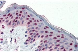 Immunohistochemistry with Human Skin lysate tissue at an antibody concentration of 5. (FOSL1 anticorps  (Middle Region))