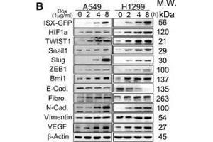 ISX expression induces TWIST1 and Snail1 expression, and promotes EMTAThe expression levels of ISX, TWIST1, Snail1, fibronectin (FN1), VEGF, and E-cadherin (CDH1) mRNA were examined in a ISX-GFP inducible Tet-ON transformants at 8 h after addition of DOX. (Vimentin anticorps)