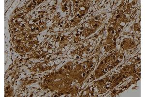 ABIN6275528 at 1/100 staining Human kidney tissue by IHC-P. (STK32C anticorps  (Internal Region))
