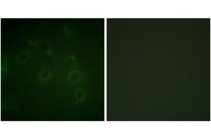 Immunofluorescence analysis of HuvEc cells, using CD45 (Ab-1007) Antibody.