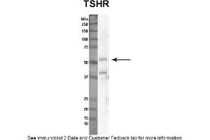Sample Type: Nthy-ori cell lysate (50ug)Primary Dilution: 1:1000Secondary Antibody: anti-rabbit HRPSecondary Dilution: 1:2000Image Submitted By: Anonymous (TSH receptor anticorps  (N-Term))