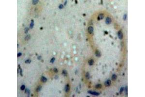 Used in DAB staining on fromalin fixed paraffin-embedded Kidney tissue (PPIA anticorps  (AA 2-164))