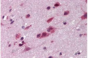 Human Brain Cortex (formalin-fixed, paraffin-embedded) stained with TNIP2 antibody ABIN290395 at 5 ug/ml followed by biotinylated goat anti-rabbit IgG secondary antibody ABIN481713, alkaline phosphatase-streptavidin and chromogen. (TNIP2 anticorps)