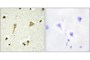 Immunohistochemistry analysis of paraffin-embedded human brain tissue, using TSC22D1 Antibody. (TSC22D1 anticorps  (AA 71-120))