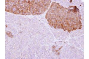 IHC-P Image IL22 Receptor alpha 2 antibody detects IL22RA2 protein at cytosol on PC14 xenograft by immunohistochemical analysis.