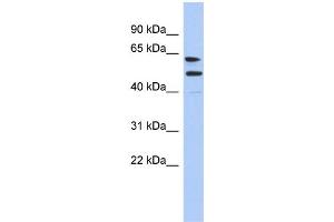 WB Suggested Anti-CXorf67 Antibody Titration: 0. (CXorf67 anticorps  (Middle Region))