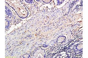 L1 rat lung lysates L2 human colon carcinoma lysates probed with Anti TIMP-1 Polyclonal Antibody, Unconjugatedat 1:200 overnight at 4 °C. (TIMP1 anticorps  (AA 131-207))