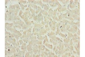 Immunohistochemistry of paraffin-embedded human heart tissue using ABIN7159481 at dilution of 1:100 (TIMP1 anticorps  (AA 24-207))