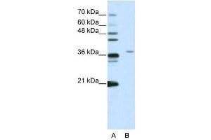 WB Suggested Anti-SART3  Antibody Titration: 2.