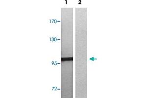 Western blot analysis of Lane 1: EGF treated 3T3 cells, Lane 2: antigen-specific peptide treated 3T3 cells with MERTK/TYRO3 (phospho Y749/681) polyclonal antibody  at 1:500-1000 dilution. (MERTK anticorps  (pTyr681, pTyr749))