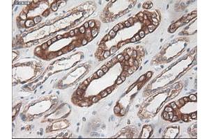 Image no. 4 for anti-Keratin 18 (KRT18) (AA 69-372) antibody (ABIN1491637)