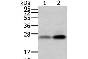 Western blot analysis of Mouse trachea and brain tissue using WFDC5 Polyclonal Antibody at dilution of 1:1100 (WFDC5 anticorps)