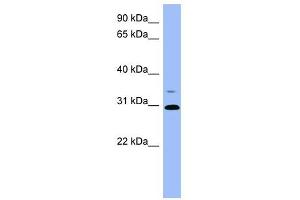PSPH antibody used at 1 ug/ml to detect target protein. (PSPH anticorps  (Middle Region))