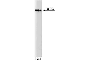 Western blot analysis of PI3-Kinase C2beta on a HeLa lysate.
