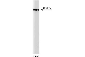 Western blot analysis of PI3-Kinase C2beta on a HeLa lysate. (PIK3C2B anticorps  (AA 16-209))