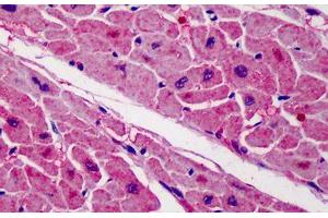 Human Heart: Formalin-Fixed, Paraffin-Embedded (FFPE) (ZBTB7A anticorps  (C-Term))