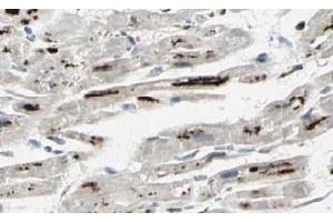 Image no. 2 for anti-Protein Phosphatase 1, Regulatory Subunit 13 Like (PPP1R13L) (AA 780-797), (Isoform 1) antibody (ABIN401339) (PPP1R13L anticorps  (Isoform 1))
