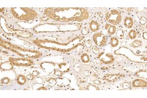 Detection of CRYl1 in Human Kidney Tissue using Polyclonal Antibody to Crystallin Lambda 1 (CRYl1) (CRYL1 anticorps  (AA 24-232))
