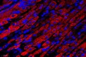 Immunofluorescent analysis of paraformaldehyde-fixed mouse stomach using,NCKAP1 (ABIN7074784) at dilution of 1: 1000 (NCKAP1 anticorps)