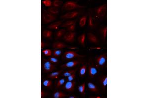 Immunofluorescence (IF) image for anti-Protein Inhibitor of Activated STAT, 2 (PIAS2) antibody (ABIN1876855) (PIAS2 anticorps)