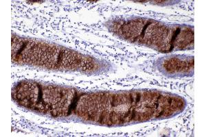 IHC analysis of MUC2 using anti-MUC2 antibody . (MUC2 anticorps)