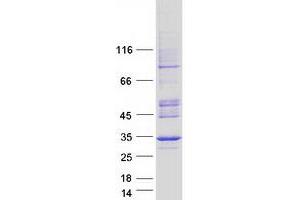 Validation with Western Blot