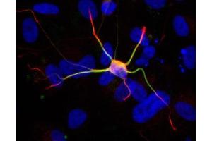 ICC/IF Image Immunofluorescent staining of neurons derived from human ESC with a 1:200 dilution of GeneTex anti-doublecortin antibody, Anti-doublecortin antibody (red) colocalizes with anti-MAP2 antibody (green).
