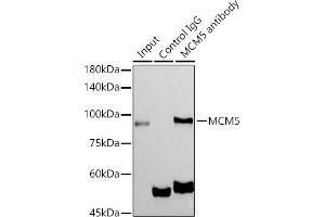 Immunoprecipitation analysis of 300 μg extracts of MCF7 cells using 3 μg MCM5 antibody (ABIN7268543).