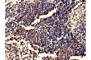 Immunohistochemistry of paraffin-embedded human spleen tissue using ABIN7174020 at dilution of 1:100