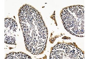 ABIN7096261 and ABIN7100323 at 1/100 staining mouse testis tissue by IHC-P. (SLC25A43 anticorps)