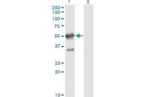 Western Blotting (WB) image for anti-A Kinase (PRKA) Anchor Protein 17A (AKAP17A) (AA 53-157) antibody (ABIN599035) (SFRS17A anticorps  (AA 53-157))