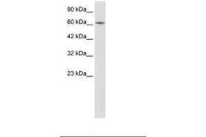Image no. 1 for anti-Kelch-Like 28 (KLHL28) (AA 380-429) antibody (ABIN202773) (KLHL28 anticorps  (AA 380-429))