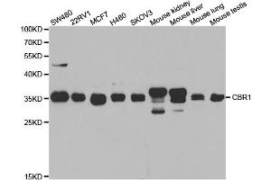 Western blot analysis of extracts of various cell lines, using CBR1 antibody (ABIN5973163) at 1/1000 dilution. (CBR1 anticorps)