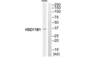 Western blot analysis of extracts from HuvEc cells, using HSD11B1 antibody. (HSD11B1 anticorps  (N-Term))