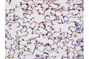 Formalin-fixed and paraffin embedded mouse embryo labeled with Anti Prkg1/cGKI Polyclonal Antibody, Unconjugated (ABIN720221) at 1:200 followed by conjugation to the secondary antibody and DAB staining