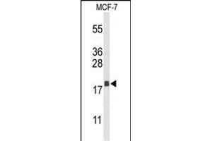 Western blot analysis of AGR3 Antibody (C-term) (ABIN653373 and ABIN2842844) in MCF-7 cell line lysates (35 μg/lane). (AGR3 anticorps  (C-Term))