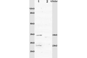 L1 rat brain lysates L2 mouse intestine lysates probed with Anti IGFBP6 Polyclonal Antibody, Unconjugated (ABIN753298) at 1:200 overnight at 4 °C.