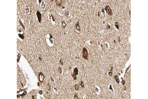 ABIN6266907 at 1/100 staining human brain tissue sections by IHC-P.