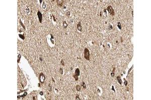 ABIN6266907 at 1/100 staining human brain tissue sections by IHC-P. (GUCY1B3 anticorps  (N-Term))